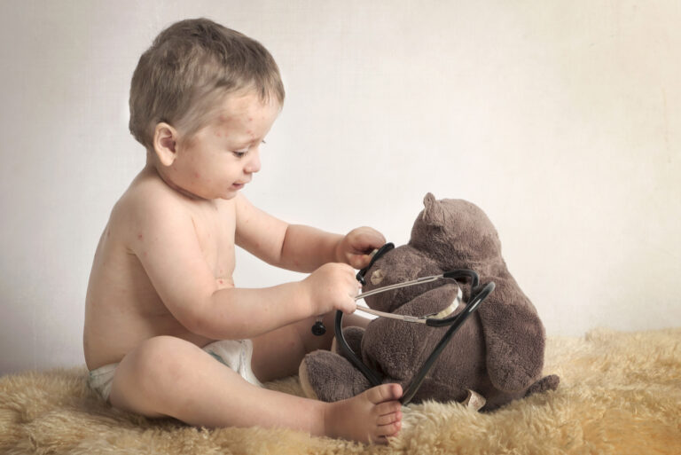 la varicelle chez le bébé photo exemple